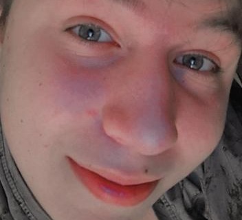 Portret młodej osoby z bliska, z lekkim uśmiechem i widocznym znamieniem na twarzy. Ujęcie z dołu, oświetlenie nierównomierne.