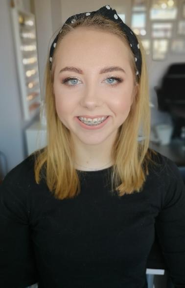 Portret uśmiechniętej blondynki z delikatnym makijażem oczu i ust, widoczne aparaty ortodontyczne, czarna opaska w białe kropki na włosach.