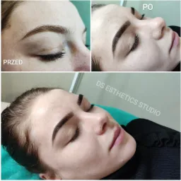 Zdjęcie 'przed' i 'po' zabiegu stylizacji brwi, widoczne subtelne różnice w kształcie i kolorze włosków na tle skóry z piegami, ujęcie z bliska.