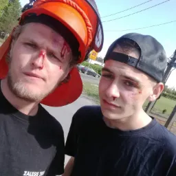 Dwóch mężczyzn po pracy, jeden z hełmem ochronnym i obaj z drobnymi obrażeniami na twarzy, stojący na tle słupów energetycznych i zieleni.