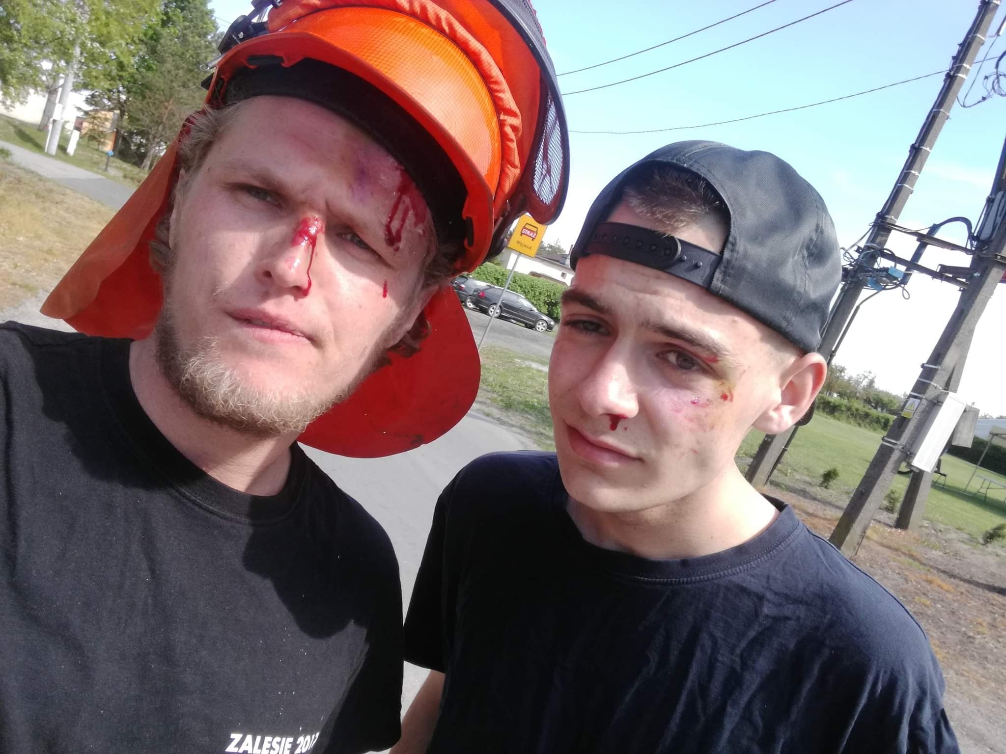 Dwóch mężczyzn po pracy, jeden z hełmem ochronnym i obaj z drobnymi obrażeniami na twarzy, stojący na tle słupów energetycznych i zieleni.
