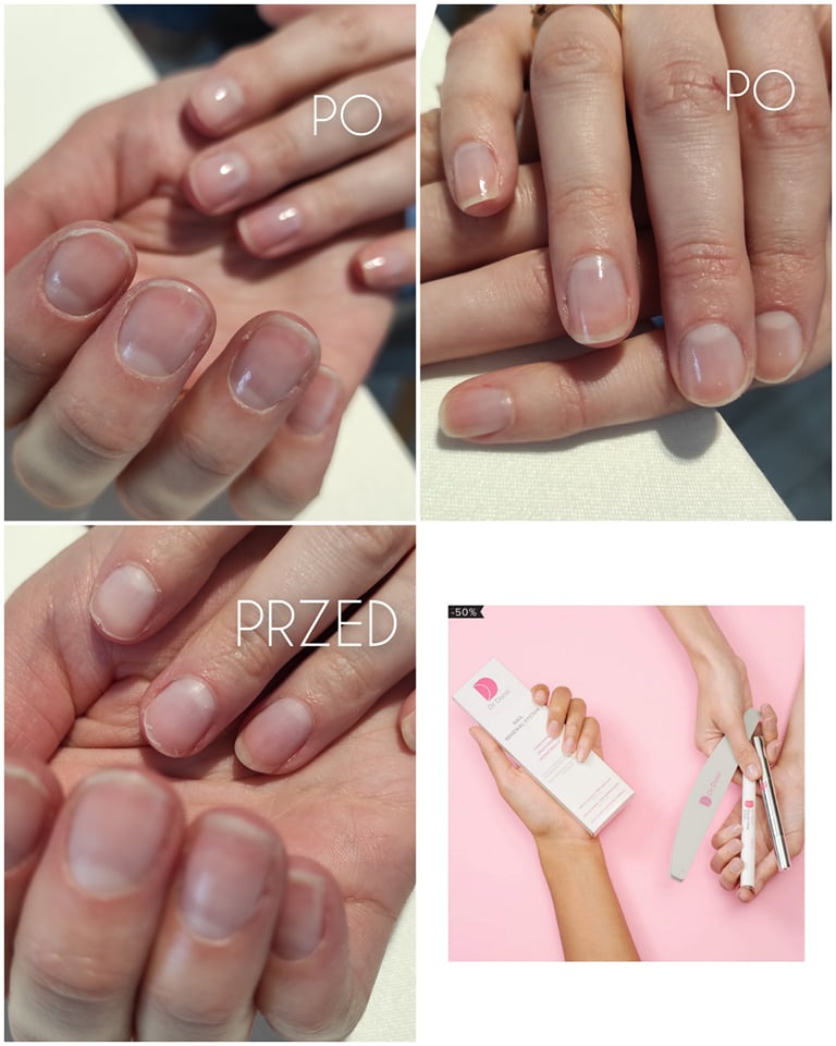 Porównanie stanu paznokci przed i po zabiegu manicure, ukazujące różnicę w wyglądzie i kondycji. Na różowym tle dłoń trzyma zestaw do pielęgnacji paznokci.