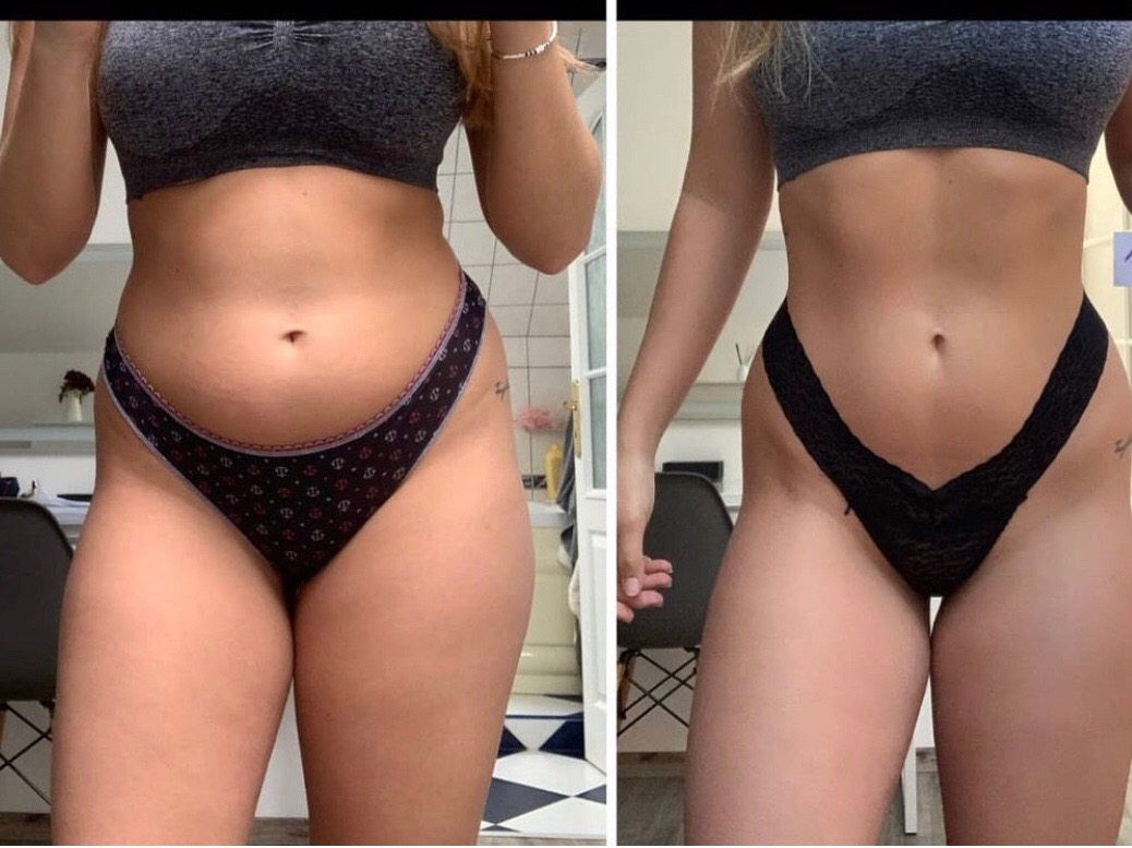 Kobieta prezentuje efekty metamorfozy sylwetki, porównanie figury przed i po, widoczne zmiany w obwodzie talii i ud, na obu zdjęciach w bieliźnie sportowej, w tle fragment domowej kuchni.