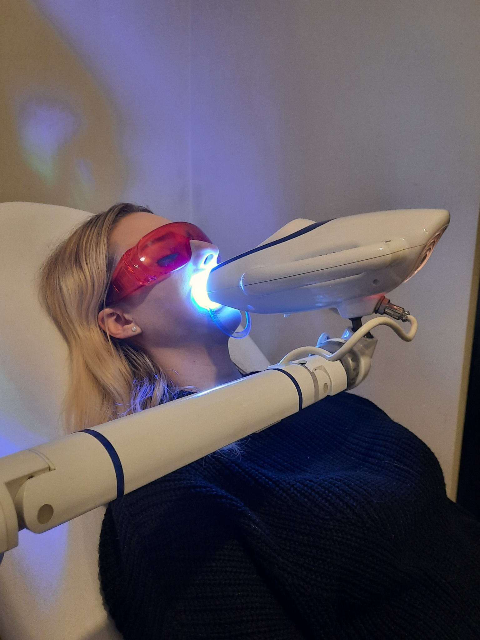 Pacjentka w okularach ochronnych poddawana zabiegowi wybielania zębów lampą LED, widoczny biały aparat i niebieskie światło.