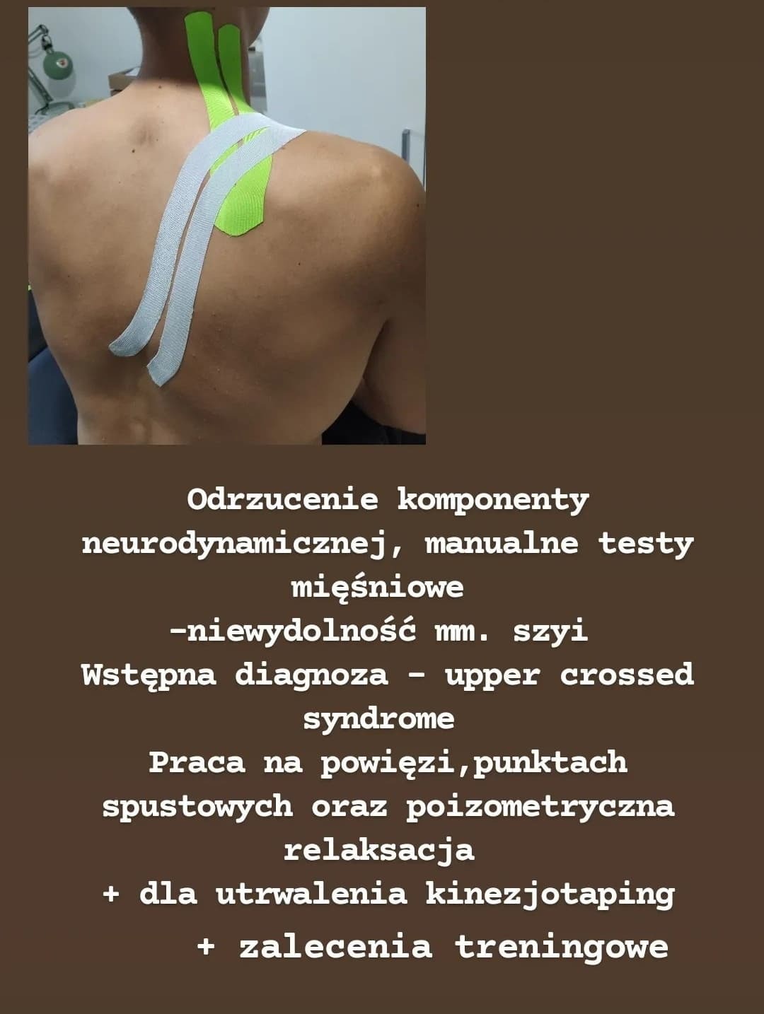 Plecy pacjenta z aplikacją taśm kinezjologicznych w kolorze zielonym i szarym, prawdopodobnie w celu wsparcia mięśni szyi i ramion.