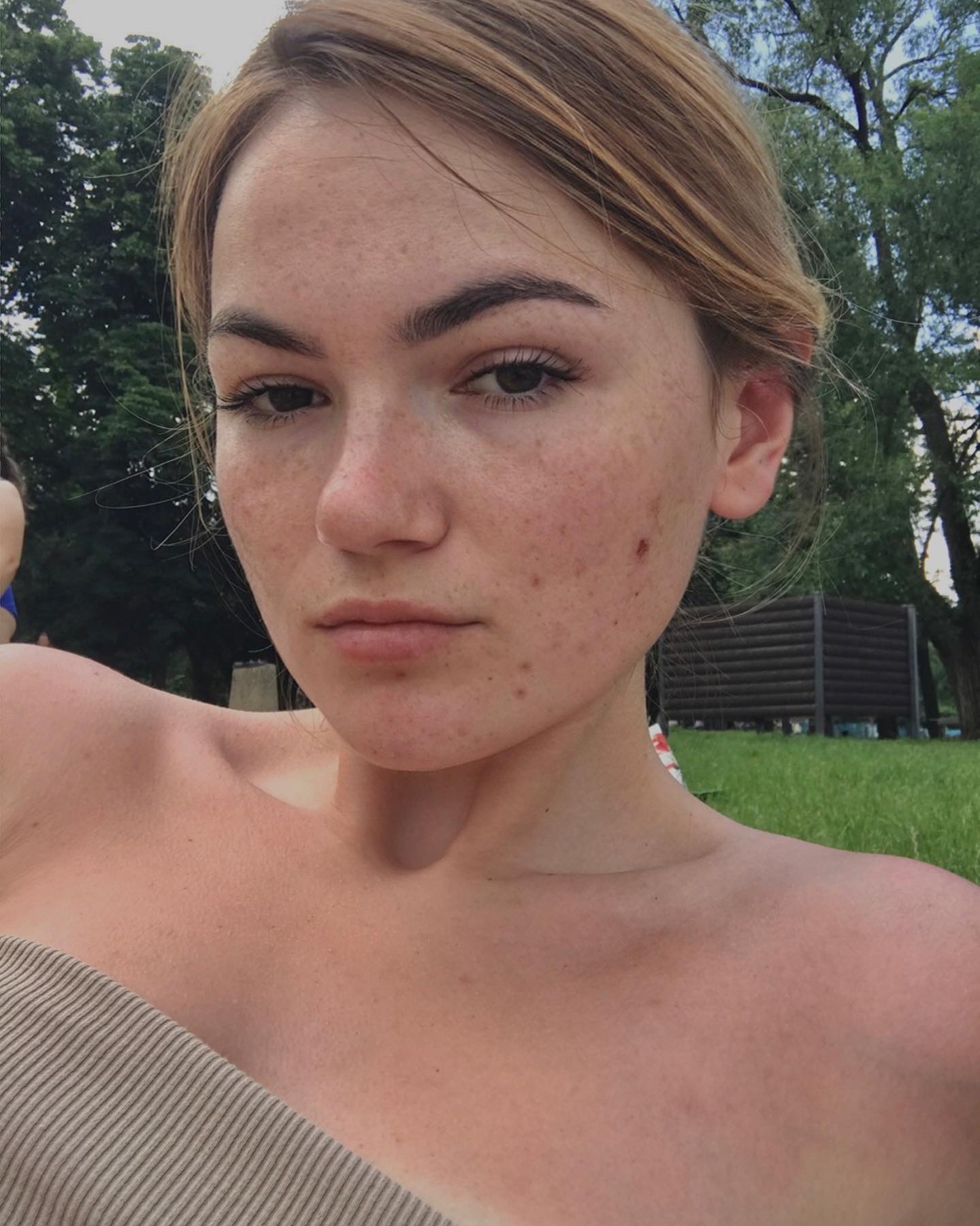 Portret młodej kobiety z piegami, z delikatnym makijażem i włosami upiętymi do tyłu, na tle zieleni parku.