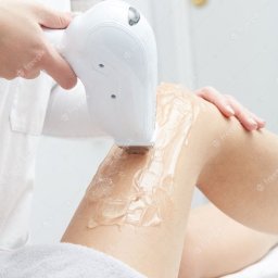 Depilacja Laserowa, laserem diodowym