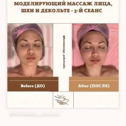 Facemassage_yakovenko - Kobieta w czepku kosmetycznym, zdjęcia 'przed' i 'po' modelującym zabiegu na twarz, szyję i dekolt, trzeci seans, widoczna subtelna różnica w wyglądzie skóry.