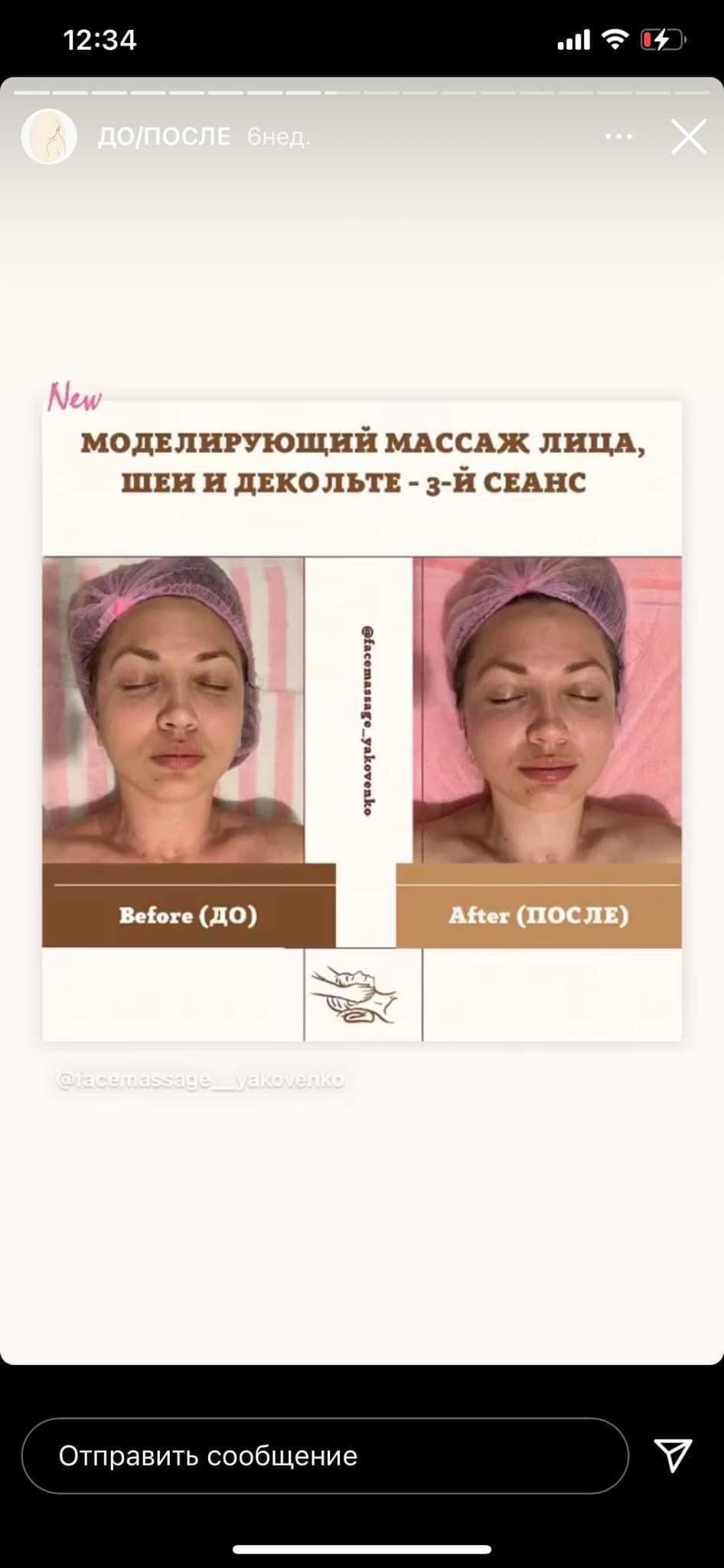 Kobieta w czepku kosmetycznym, zdjęcia 'przed' i 'po' modelującym zabiegu na twarz, szyję i dekolt, trzeci seans, widoczna subtelna różnica w wyglądzie skóry.