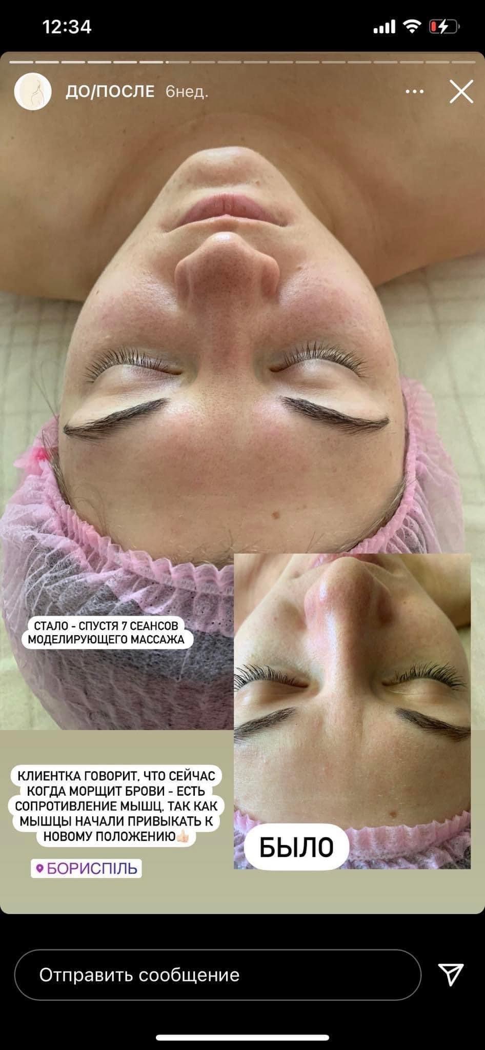 Zdjęcie typu 'przed i po' przedstawiające twarz kobiety z widocznymi brwiami po zabiegu kosmetycznym, nałożony różowy czepek ochronny na włosy, widoczny fragment ekranu telefonu z tekstem w języku...