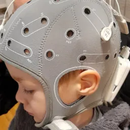 Dziecko w trakcie mikropolaryzacji mózgu.