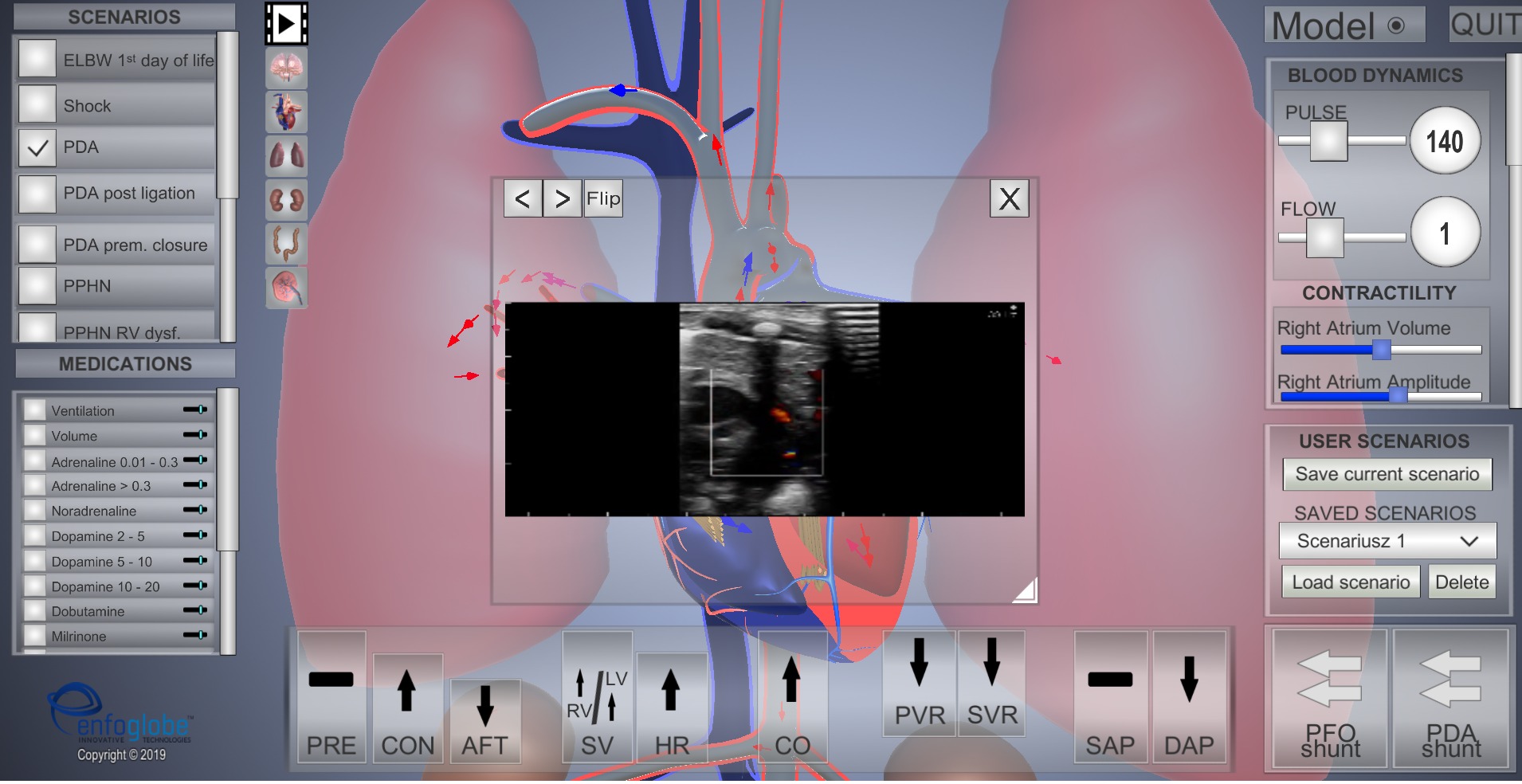 Symulacja 3D układu krążenia z widocznym obrazem USG serca, interaktywny model z regulacją parametrów hemodynamicznych i opcjami scenariuszy medycznych.