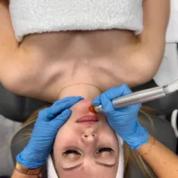 Klientka podczas zabiegu mikrodermabrazji na twarzy, widok z g&oacute;ry, niebieskie rękawiczki, biała opaska i ręcznik.