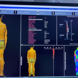 Rehabilitant Przylesie 2