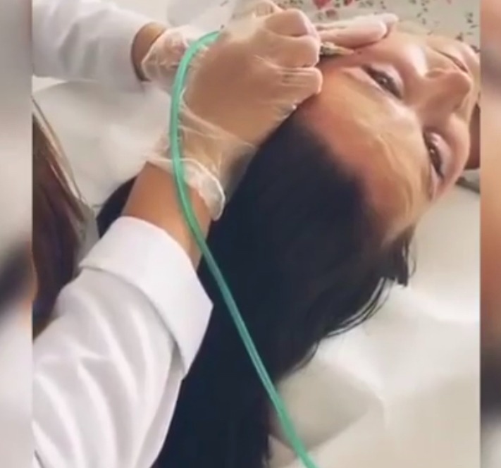 Zabieg na twarzy pacjentki leżącej na leżance, wykonywany przez osobę w białym uniformie i rękawiczkach, z użyciem cienkiej rurki doprowadzającej powietrze.