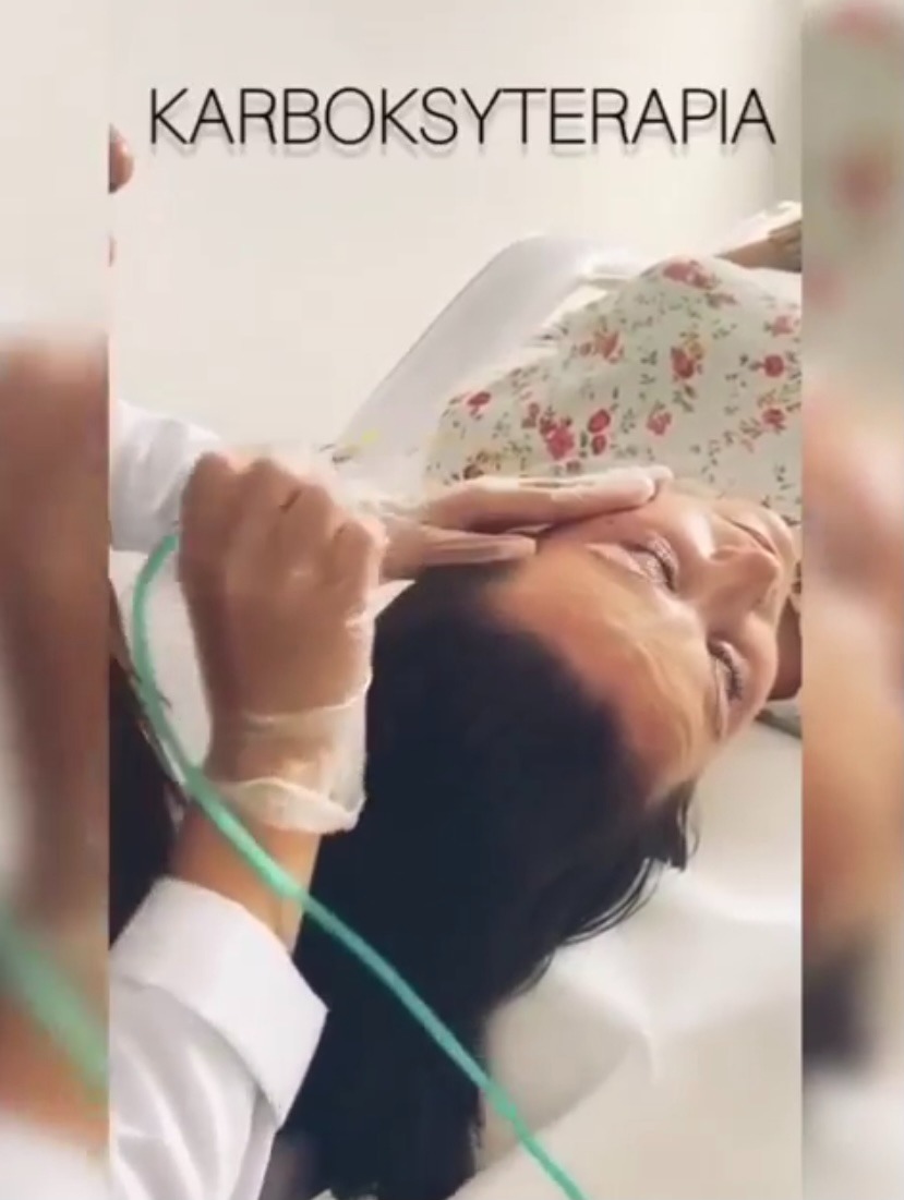 Karboksyterapia twarzy wykonywana w Koninie: lekarz w rękawiczkach aplikuje gaz za pomocą cienkiej igły pacjentce leżącej na leżance.