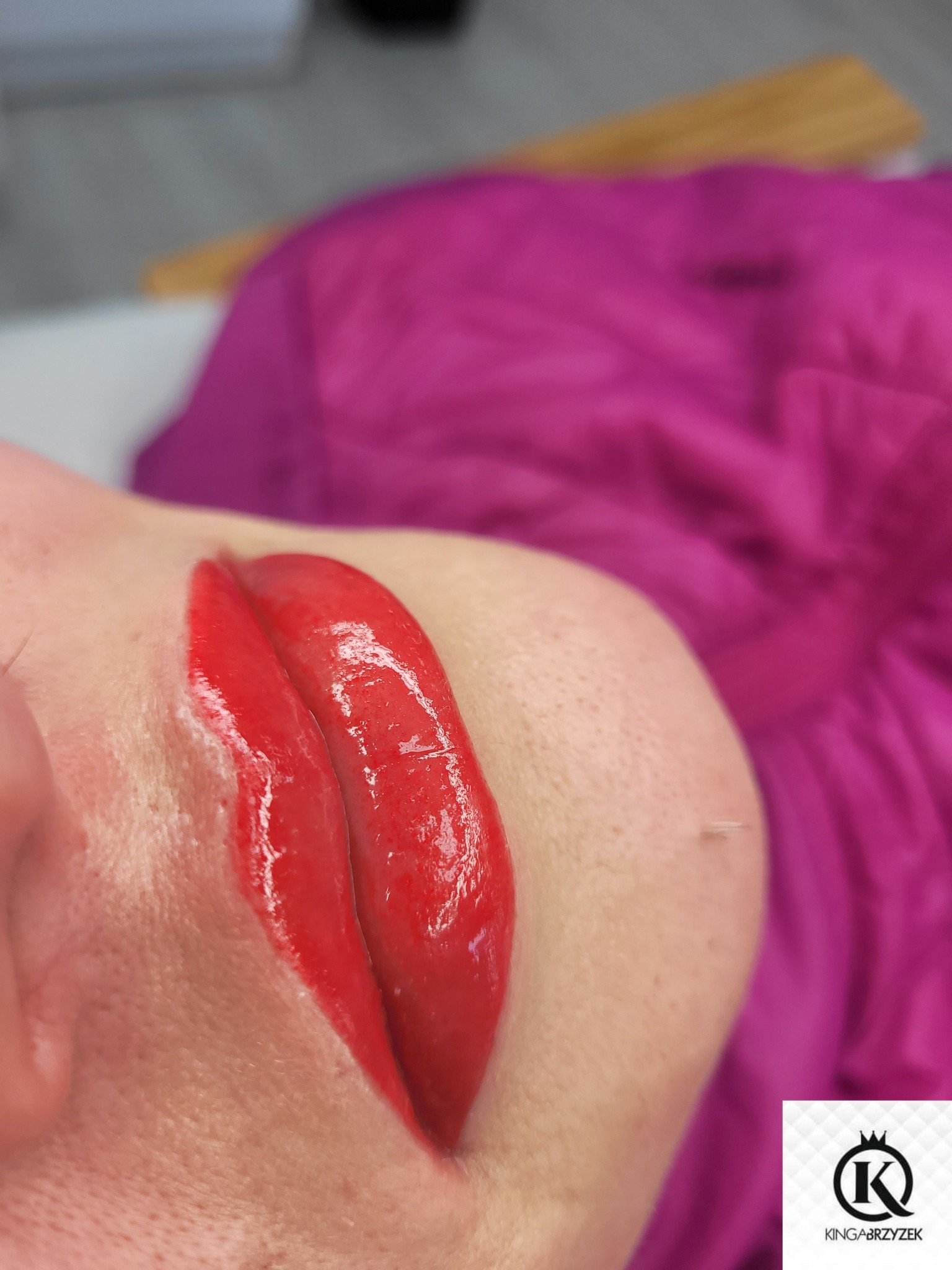 Usta kobiety pokryte intensywnie czerwoną, błyszczącą substancją, prawdopodobnie podczas zabiegu pigmentacji permanentnej, z widoczną igłą w skórze i fuksjowym tłem.