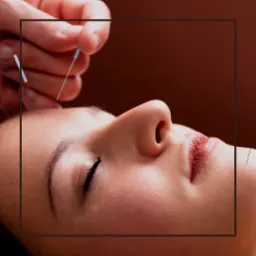 Kobieta z zamkniętymi oczami poddawana zabiegowi nakłuwania igłami przez terapeutę, zbliżenie na twarz i dłoń.