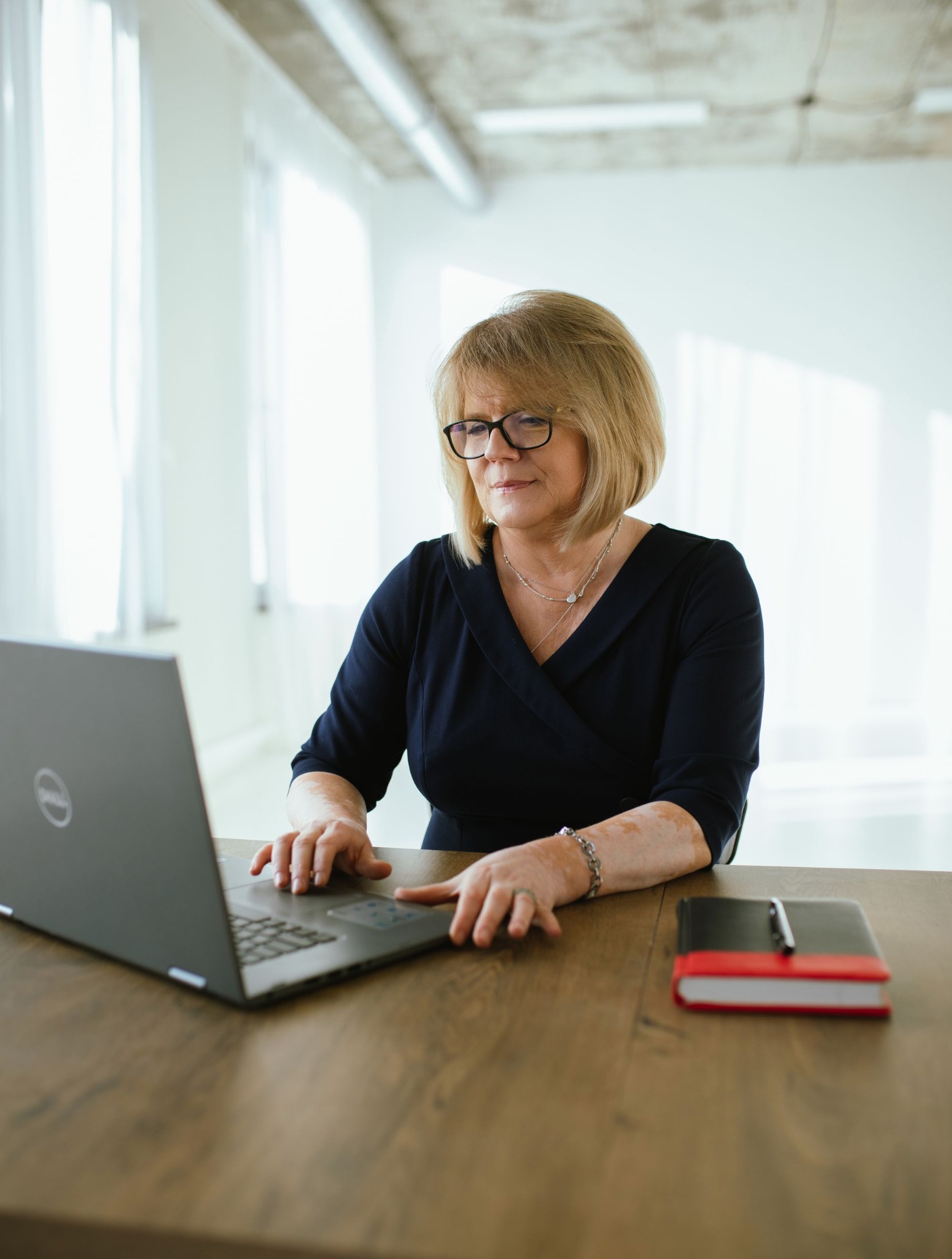 Kobieta w okularach, w biurowym wnętrzu, pracuje na laptopie, obok leży notatnik z długopisem. Widoczne białe plamy na skórze dłoni.