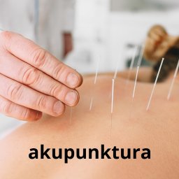 akupunktura łódź