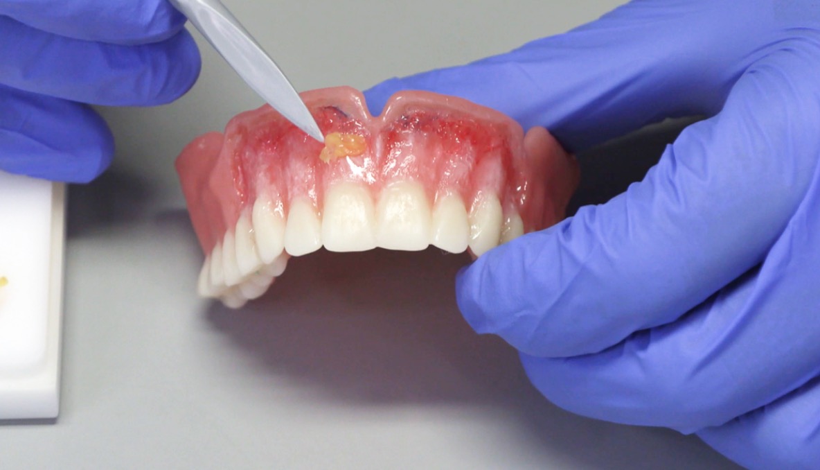 Formowanie protezy zębowej przy użyciu narzędzia przez osobę w niebieskich rękawicach ochronnych; widoczne detale imitacji dziąseł i zębów.