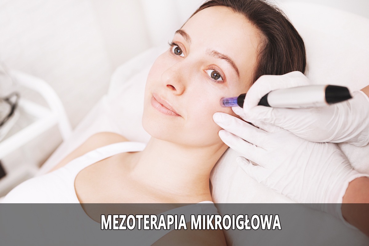 Kobieta poddawana zabiegowi mezoterapii mikroigłowej na policzku w gabinecie kosmetycznym, widoczne białe rękawiczki ochronne i urządzenie z niebieskimi igłami.