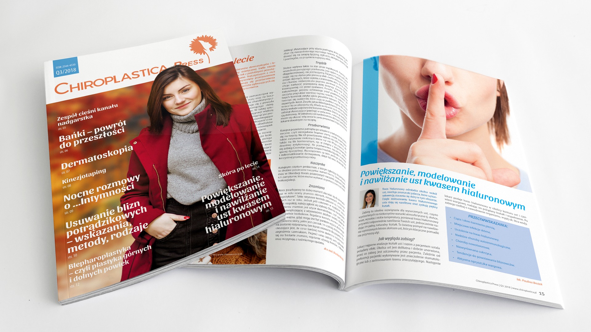 Otwarta gazeta z artykułem o powiększaniu ust kwasem hialuronowym, z ilustracją modelki z palcem na ustach.