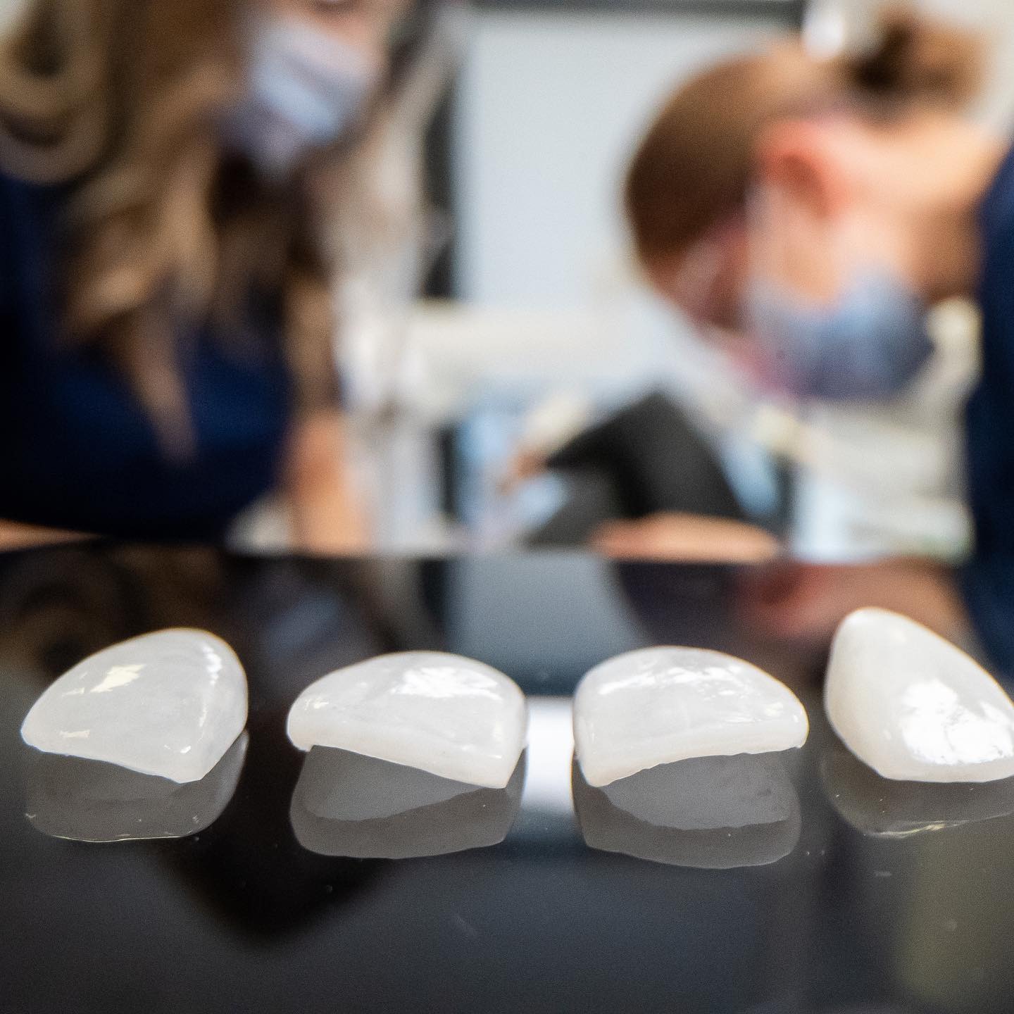 Cztery licówki porcelanowe ułożone na czarnej, błyszczącej powierzchni, z rozmytymi postaciami lekarzy w maseczkach w tle.