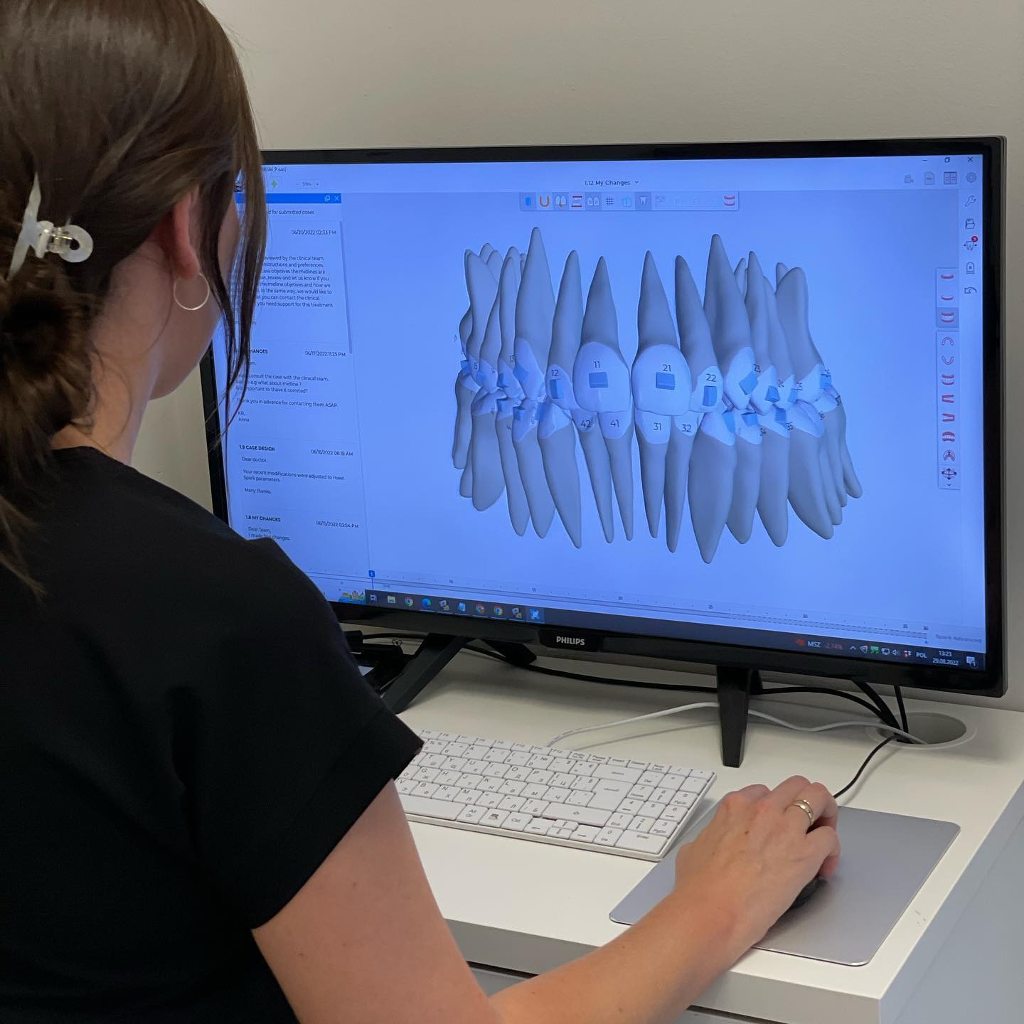 Technik dentystyczny analizuje na monitorze komputera trójwymiarowy model uzębienia pacjenta z nałożonymi nakładkami ortodontycznymi, widoczne numery zębów i oprogramowanie do projektowania...