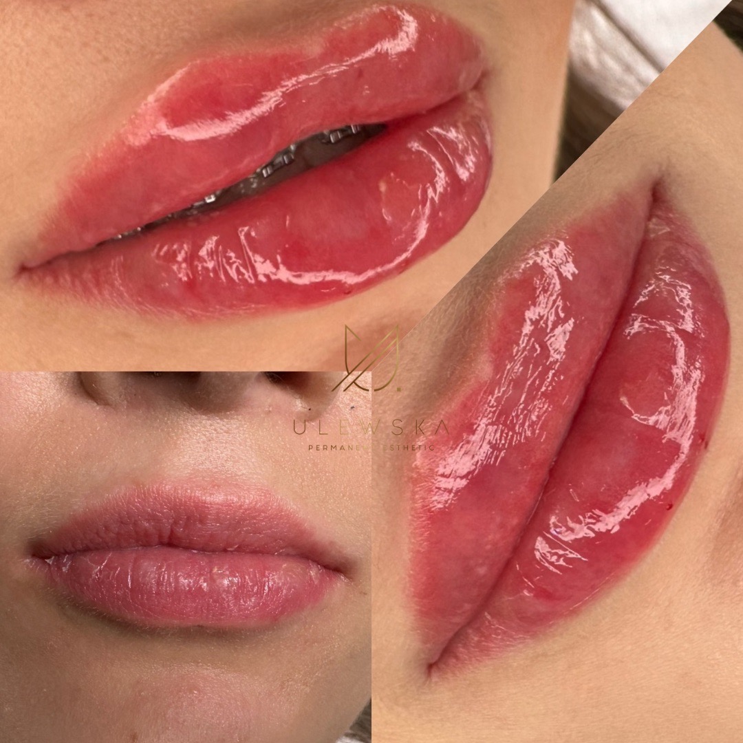 Powiększanie ust metodą na płasko BABY DOLL