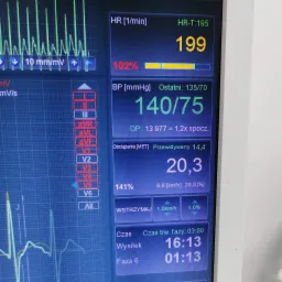 Monitor medyczny wyświetlający parametry pracy serca: tętno 199 uderzeń na minutę, ciśnienie 140/75 mmHg oraz obciążenie MET 20.3, z widocznym wykresem EKG.