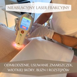 Salon Urody Skelnik Agnieszka Face & Body - Laser frakcyjny nieablacyjny w trakcie zabiegu na brzuchu pacjenta. Widoczny aparat z wyświetlaczem, rękawice ochronne i tatuaż na ramieniu osoby wykonującej zabieg.