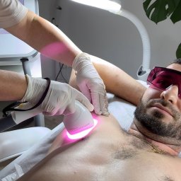 Salon Urody Skelnik Agnieszka Face & Body - Mężczyzna w okularach ochronnych poddaje się zabiegowi depilacji laserowej klatki piersiowej w gabinecie kosmetycznym. Widoczna głowica lasera i dłoń kosmetologa.