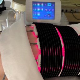 Salon Urody Skelnik Agnieszka Face & Body - Osoba poddawana zabiegowi modelowania sylwetki z użyciem urządzenia emitującego czerwone światło. Widoczne panele urządzenia i fragment twarzy klienta.