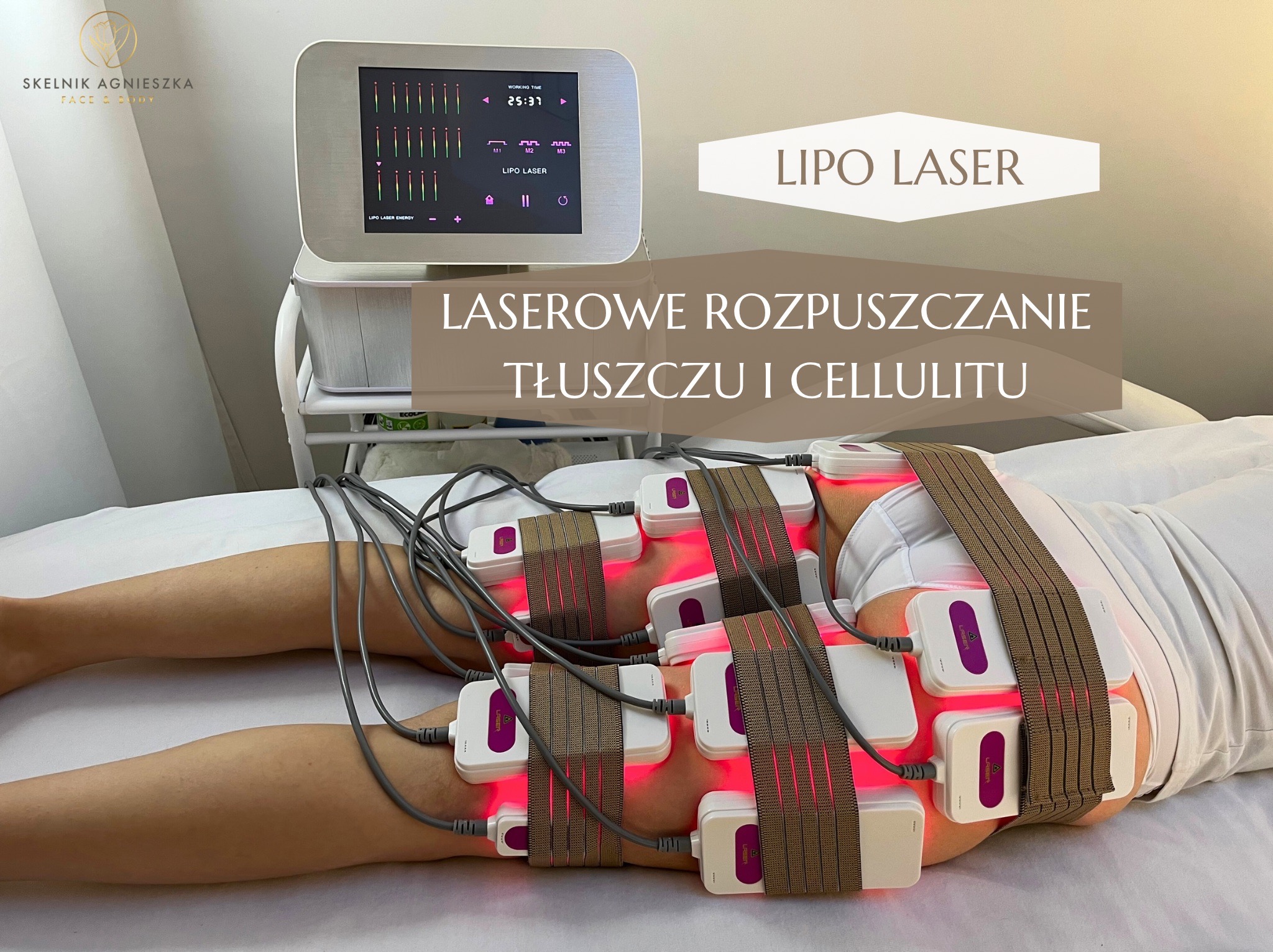 Lipo laser na udach pacjentki; białe aplikatory z czerwonym światłem, brązowe pasy mocujące, ekran urządzenia w tle. Laserowe rozpuszczanie tłuszczu.