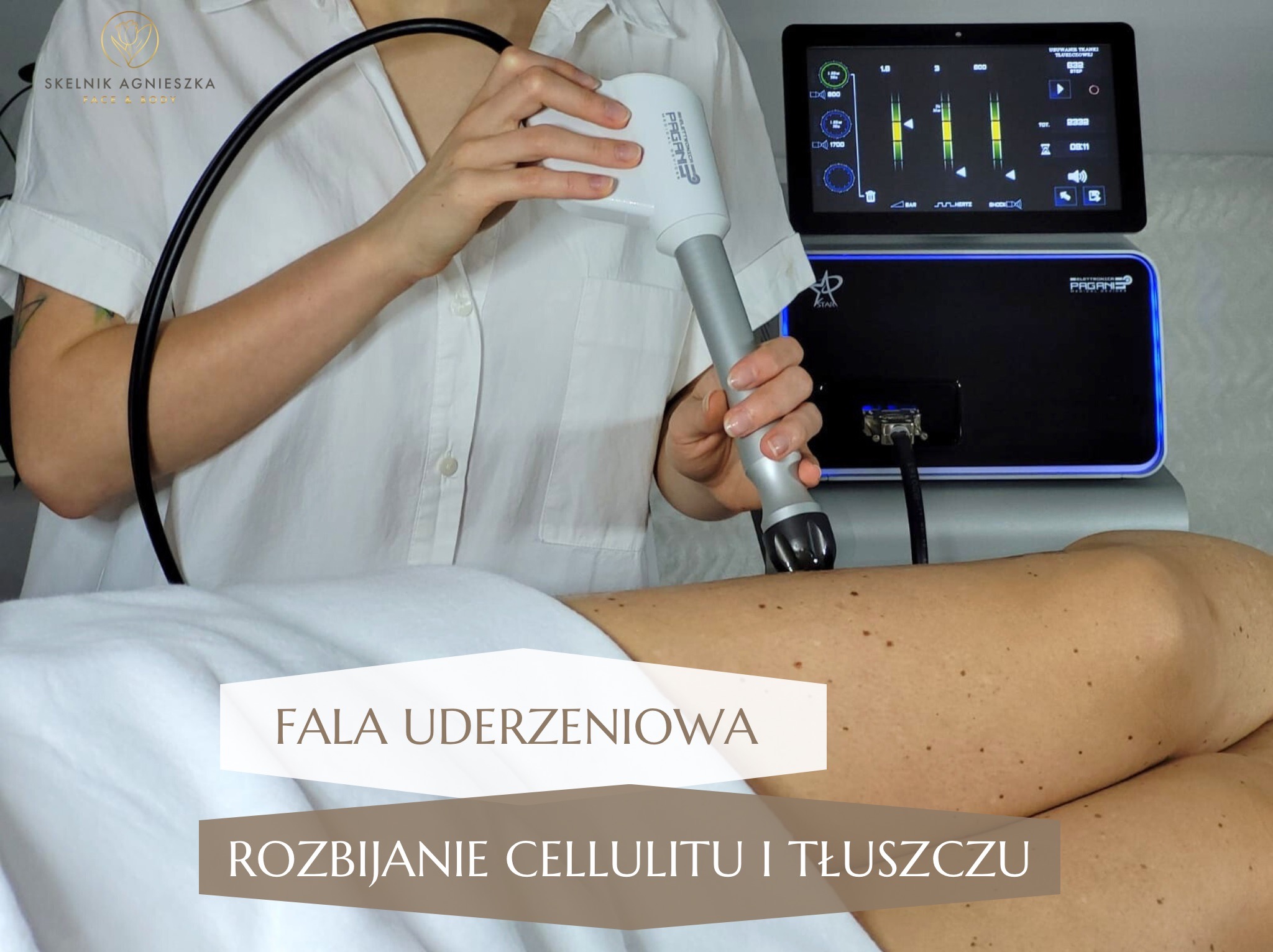 Fala uderzeniowa na udzie pacjentki, urządzenie Pagani z ekranem. Zabieg na ciało, rozbijanie cellulitu i tkanki tłuszczowej w gabinecie kosmetycznym.