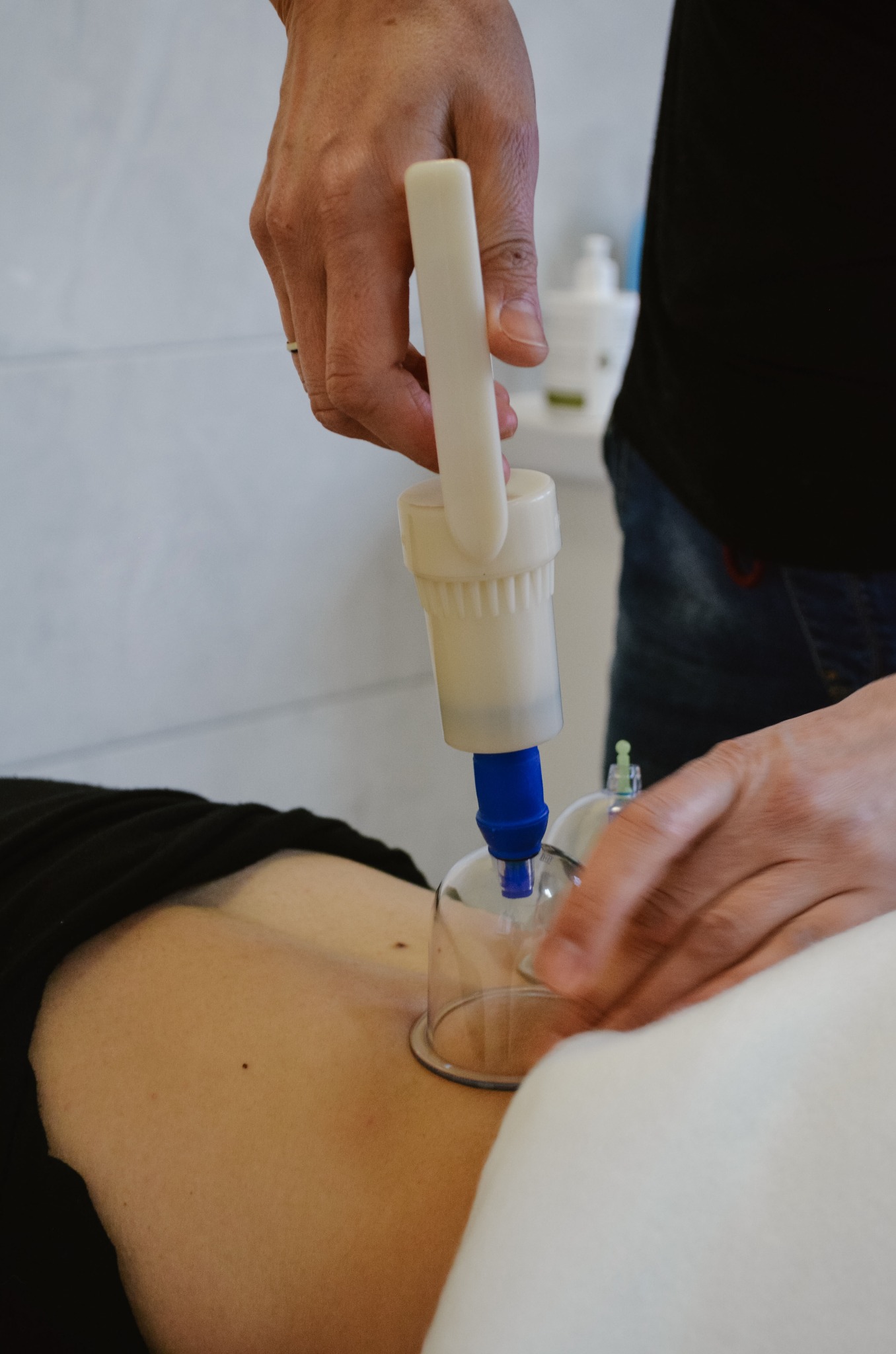 Próżniowe bańki na plecach pacjenta, terapeuta z urządzeniem do zasysania powietrza, widoczne naczynia i butelki na tle.