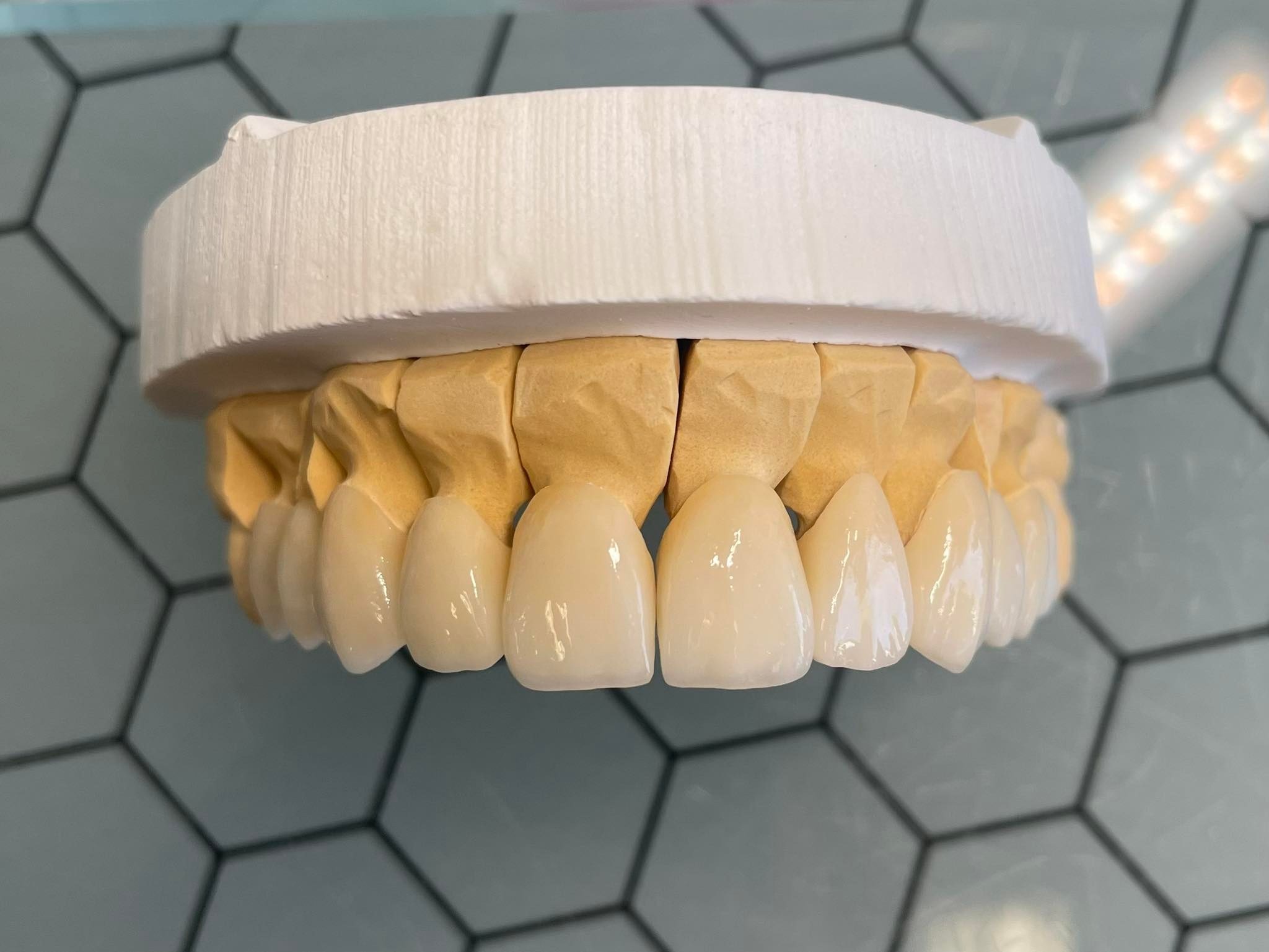 Model szczęki z ceramicznymi licówkami na gipsowym podłożu, widoczne detale struktury powierzchni licówek i ich dopasowanie do podłoża, na tle szarej, heksagonalnej płytki.