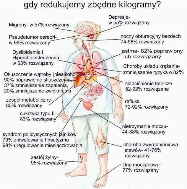 Ilustracja przedstawia schemat ciała ludzkiego z zaznaczonymi narządami i informacjami o redukcji problemów zdrowotnych po redukcji wagi. Infografika o zdrowiu.