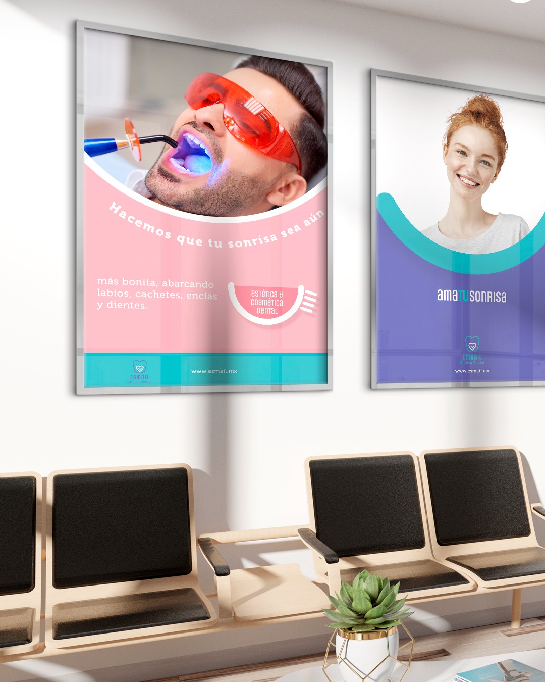 Dwa plakaty reklamowe w poczekalni z krzesłami. Plakat po lewej stronie przedstawia mężczyznę z otwartymi ustami w okularach ochronnych poddawanego zabiegowi stomatologicznemu z użyciem...