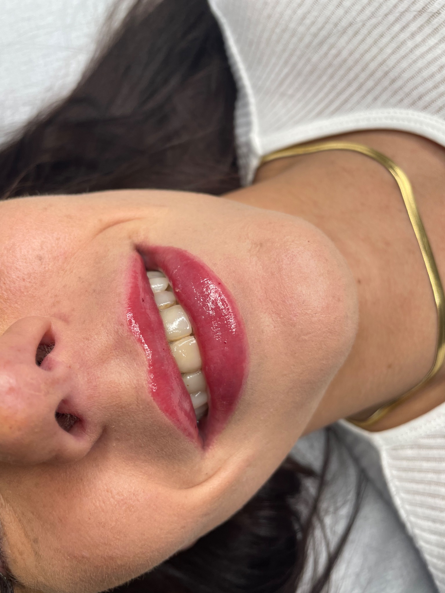 Kobieta z widocznymi, świeżo powiększonymi ustami w kolorze malinowym, złoty łańcuszek na szyi, biała bluzka, ciemne włosy