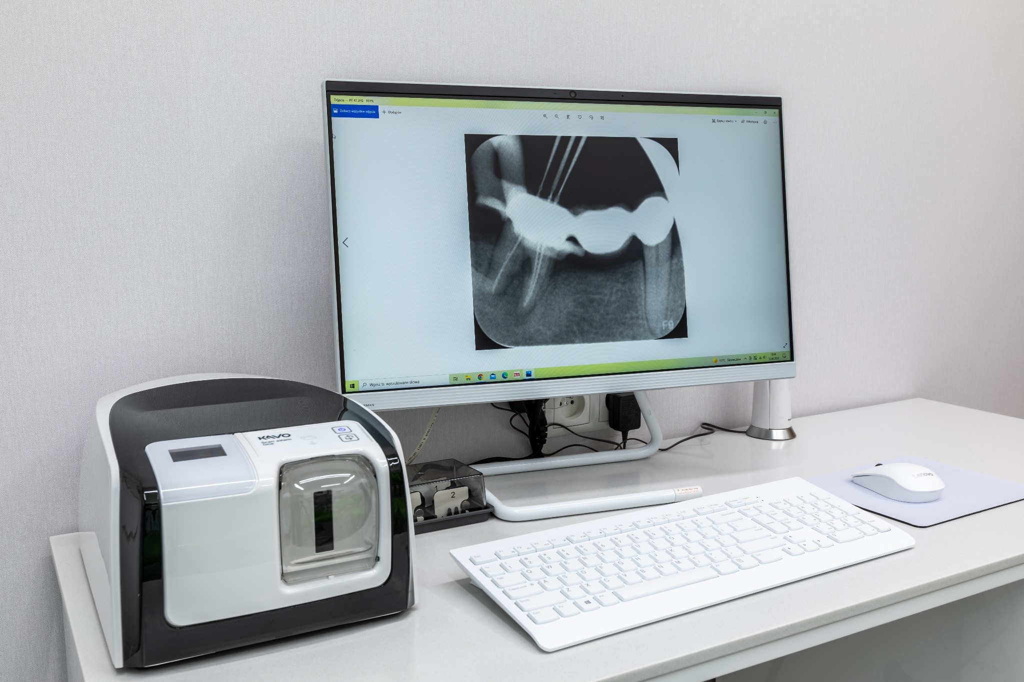 Zdjęcie rentgenowskie zęba po leczeniu kanałowym widoczne na monitorze komputera w gabinecie, obok skaner radiowizjografii Kavo, klawiatura i mysz na białym biurku.