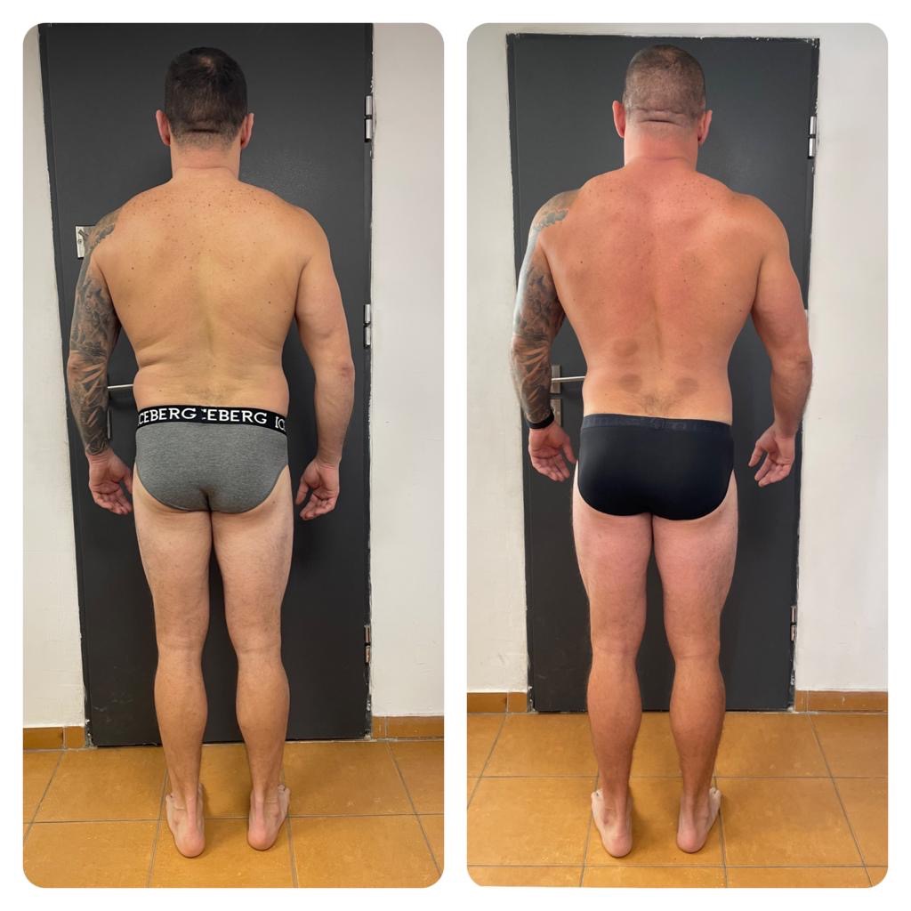 Mężczyzna, widok z tyłu, porównanie sylwetki przed i po treningu, widoczne zmiany w muskulaturze pleców i ramion, tatuaż na lewym ramieniu, ciemne ślady na plecach po zabiegu, szare slipy z napisem...