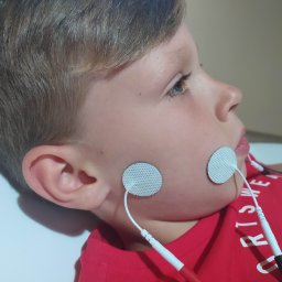 Wspomaganie kontroli mięśniowej: Fizjoterapeuta może pracować z dzieckiem, aby wzmocnić i poprawić kontrolę mięśniową w obrębie twarzy, ust i gardła. Poprawienie siły i koordynacji tych mięśni może wpłynąć na poprawę artykulacji i wyrazistości mowy.