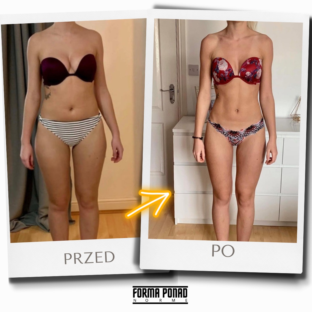 Kobieta w bieliźnie, prezentacja sylwetki przed i po, widoczna poprawa figury, strzałka wskazująca na metamorfozę, logo firmy w dolnej części.