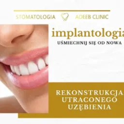 Zdjęcie przedstawia uśmiech po zabiegu implantologicznym, z widocznymi białymi zębami i fragmentem twarzy, na tle reklamy z tekstem 'implantologia' i 'rekonstrukcja utraconego uzębienia', logo...