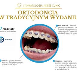 Wybór między stałym, a nakładkowym aparatem ortodontycznym zależy od indywidualnych potrzeb pacjenta.
Ostateczny wybór między stałym a nakładkowym aparatem zawsze powinien być dokonywany we współpracy z ortodontą, który zaproponuje najlepsze rozwiązanie. 