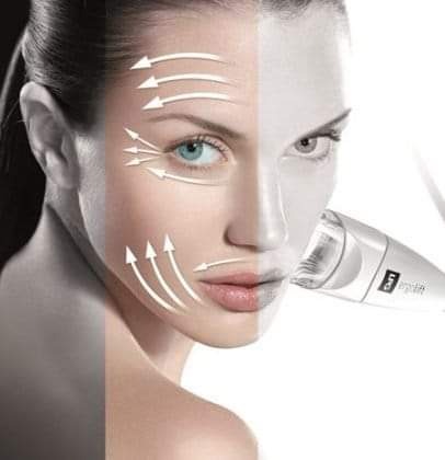 Portret kobiety z nałożonymi strzałkami wskazującymi kierunek zabiegów na twarzy, z urządzeniem do mikrodermabrazji w pobliżu policzka, połowa twarzy w odcieniach szarości.