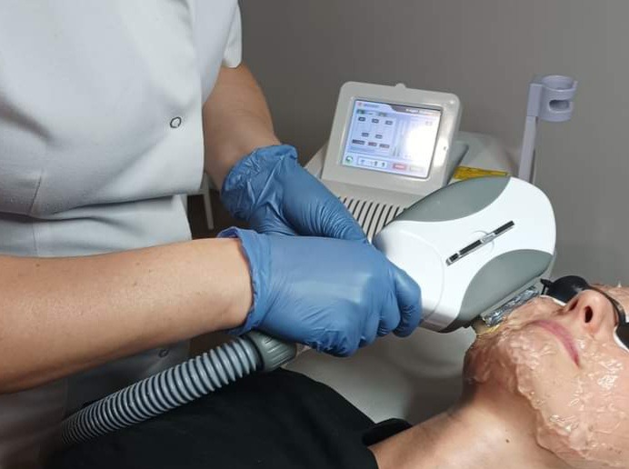 Osoba w rękawicach ochronnych wykonuje zabieg laserowy na twarzy pacjenta pokrytej kremem, widoczny ekran urządzenia z ustawieniami.