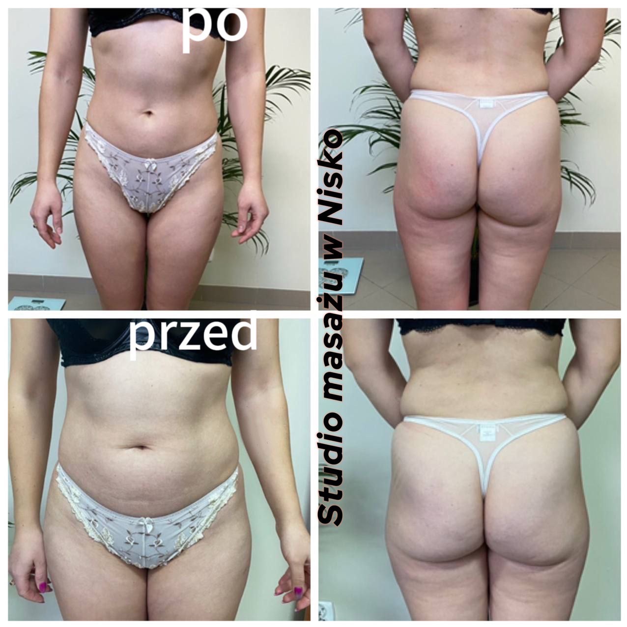 Zdjęcie 'przed i po' z przodu i z tyłu ciała kobiety w bieliźnie, ukazujące efekty zabiegu w studio masażu w Nisku, z rośliną w tle.